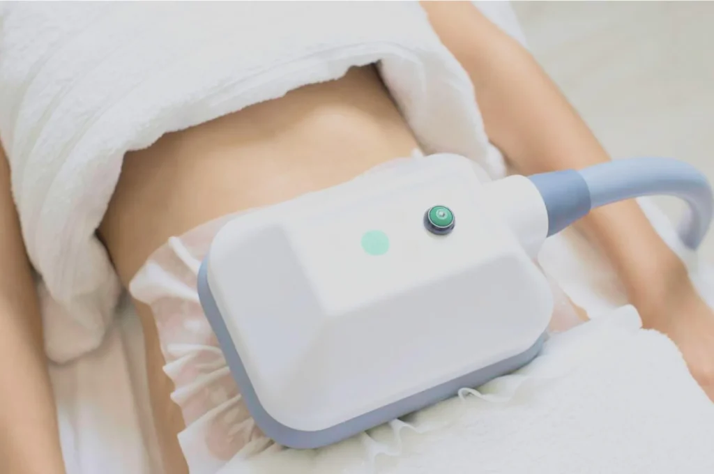 How Fat Freezing and HIFU Work Together? 3 advantages to combining Fat Freezing and HIFU Crawley