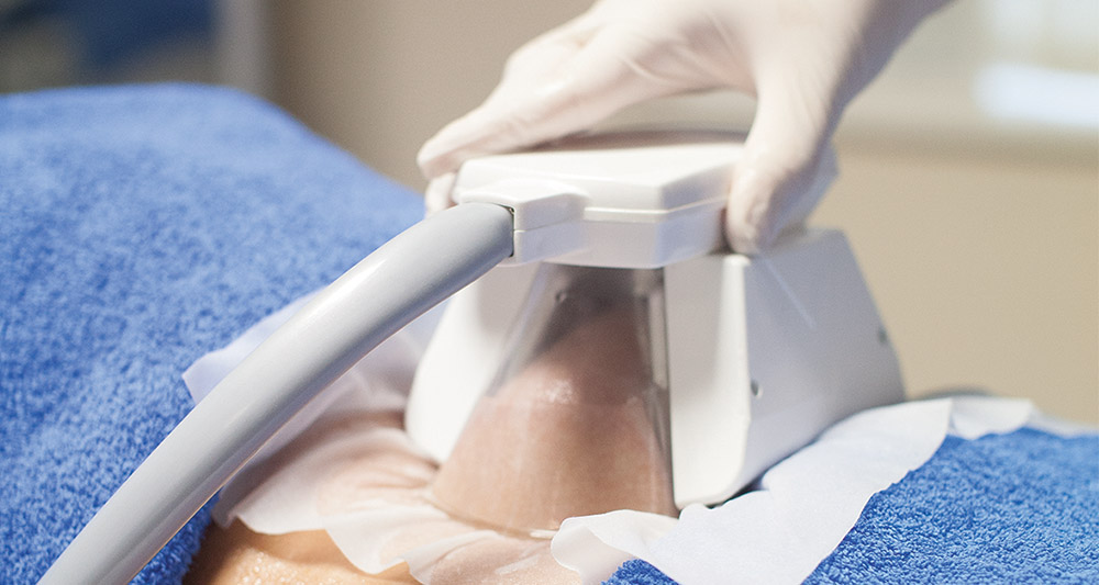 How Fat Freezing and HIFU Work Together? 2 Multiple Areas in One Session HIFU and Fat Freezing Crawley