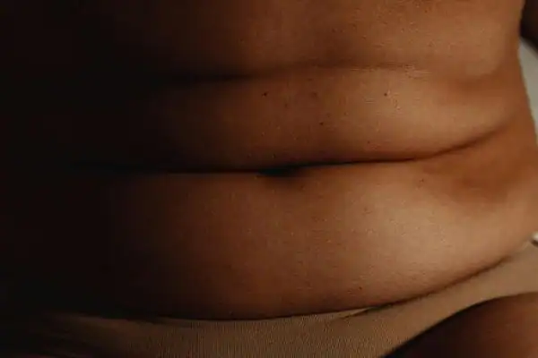 The Hidden Connection: How Stress Shapes Your Fitness and Body Composition 3 image of what stress can do on the stomach area and how Lipo 360 Crawley can help to change your body shape.