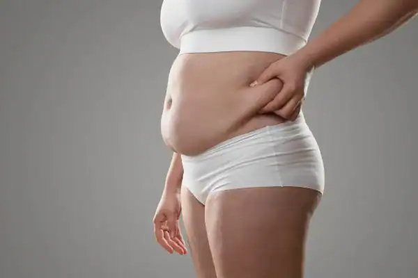 Image of stress belly Crawley How Lipo 360 can help manage your symptoms